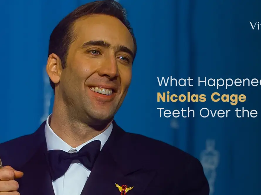 Nicolas Cage Teeth
