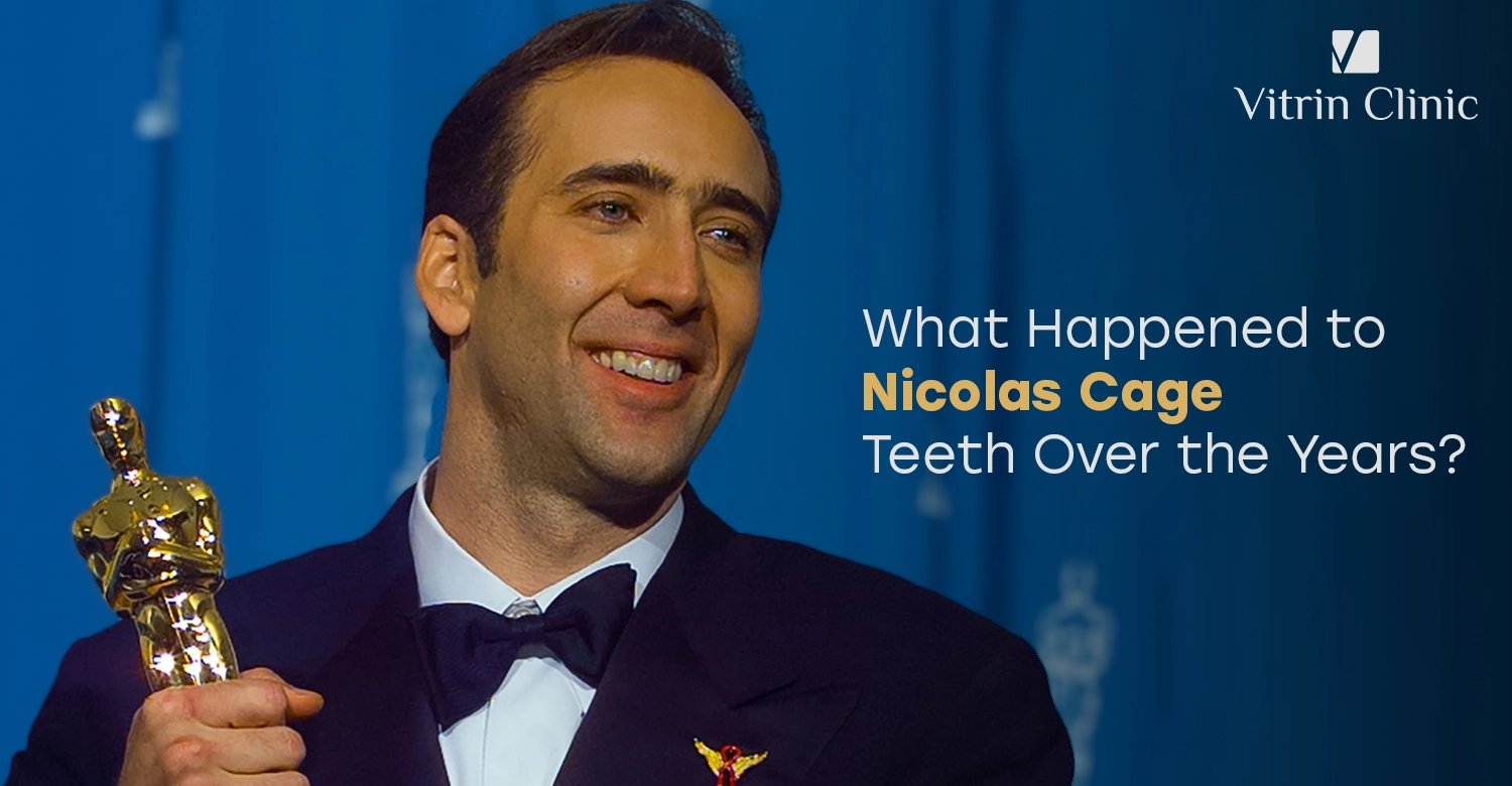 Nicolas Cage Teeth