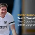 Oliver Glasner Teeth Transformation: The Coach’s Subtle Smile Upgrade