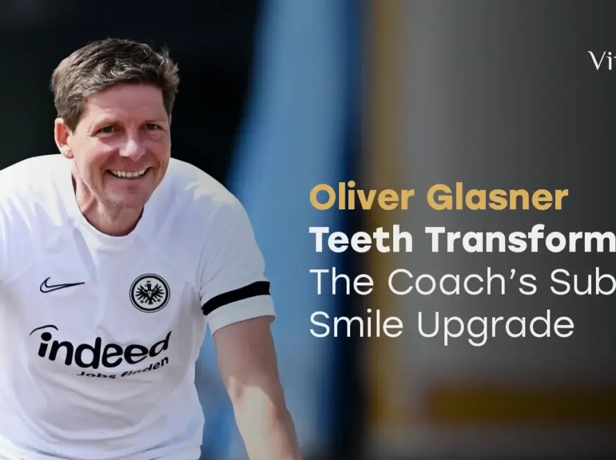 Oliver Glasner Teeth Transformation