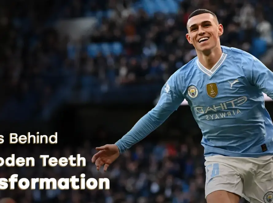 phil foden teeth