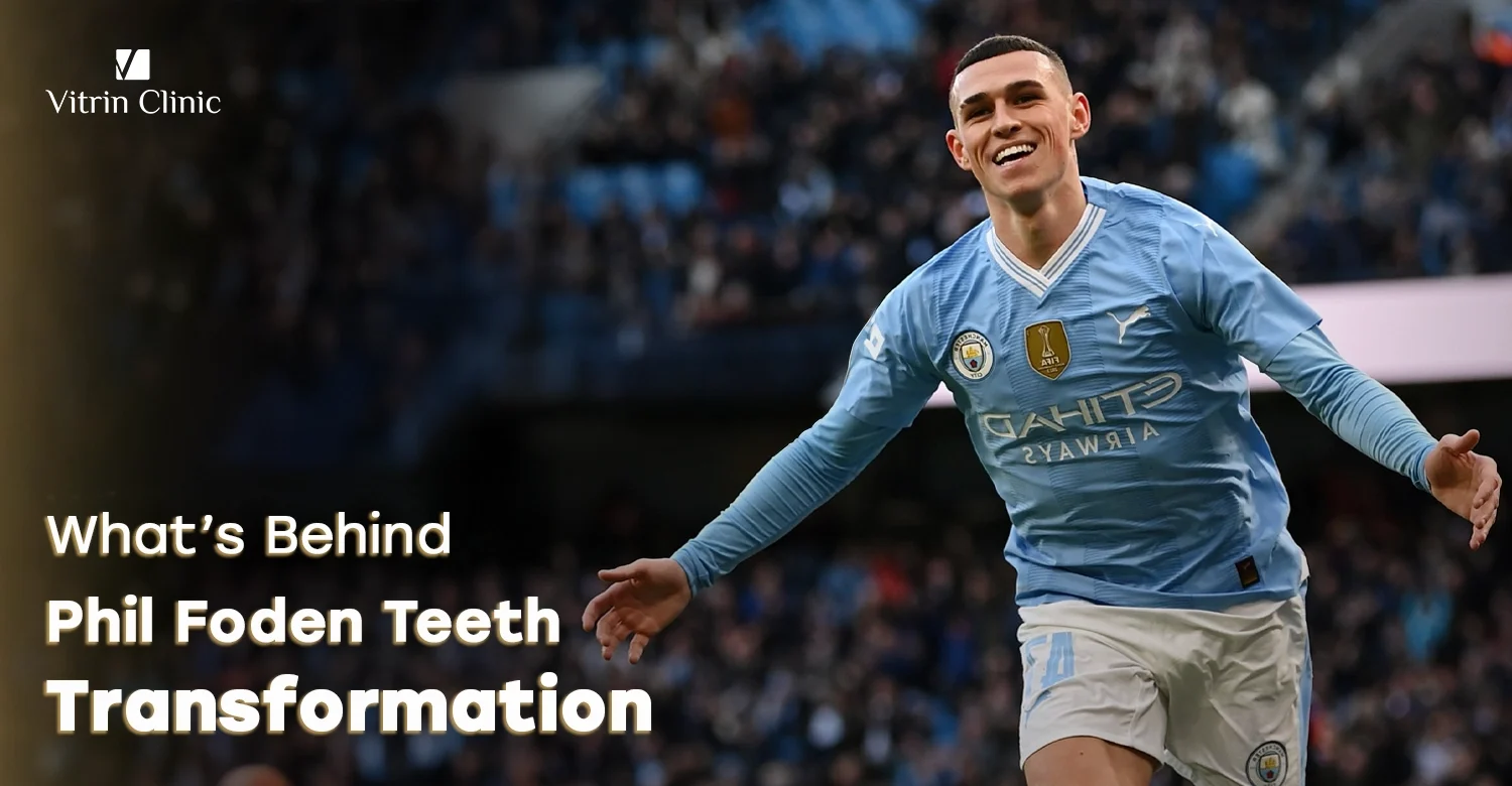 phil foden teeth