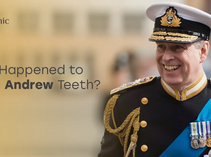 Prince Andrew Teeth