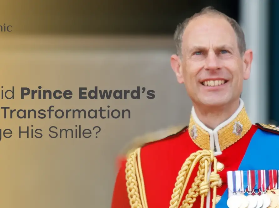 Prince Edward Teeth Transformation
