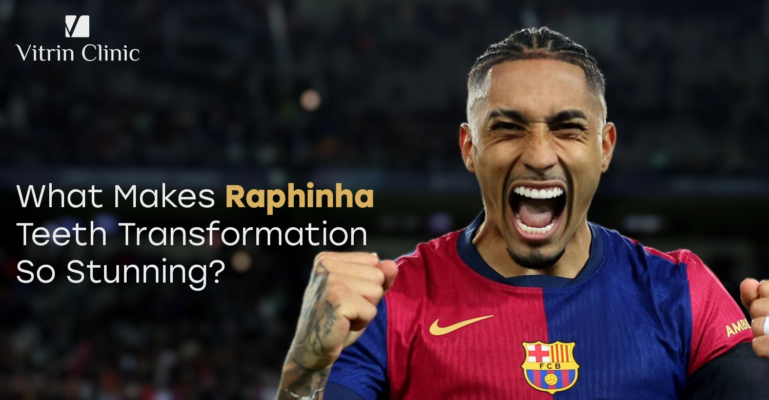 Raphinha Teeth Transformation