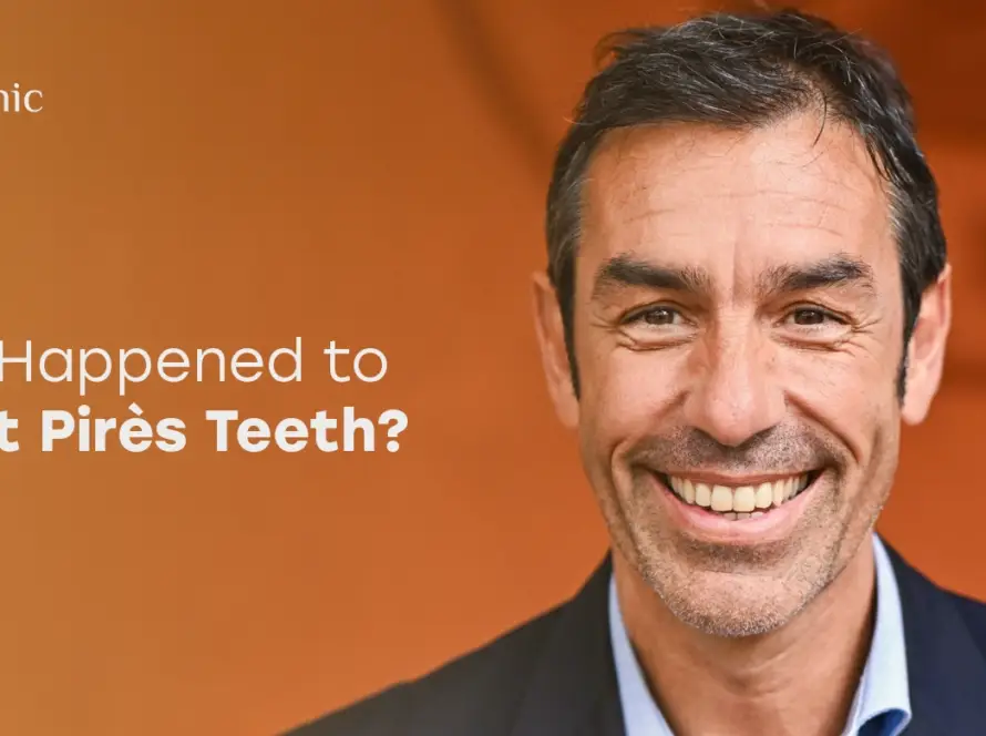 Robert Pirès Teeth