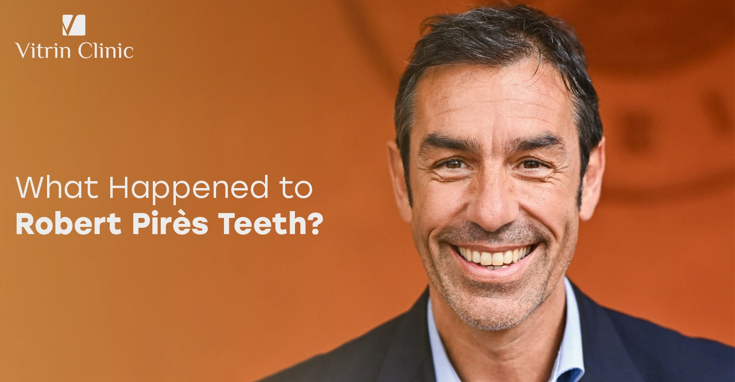 Robert Pirès Teeth