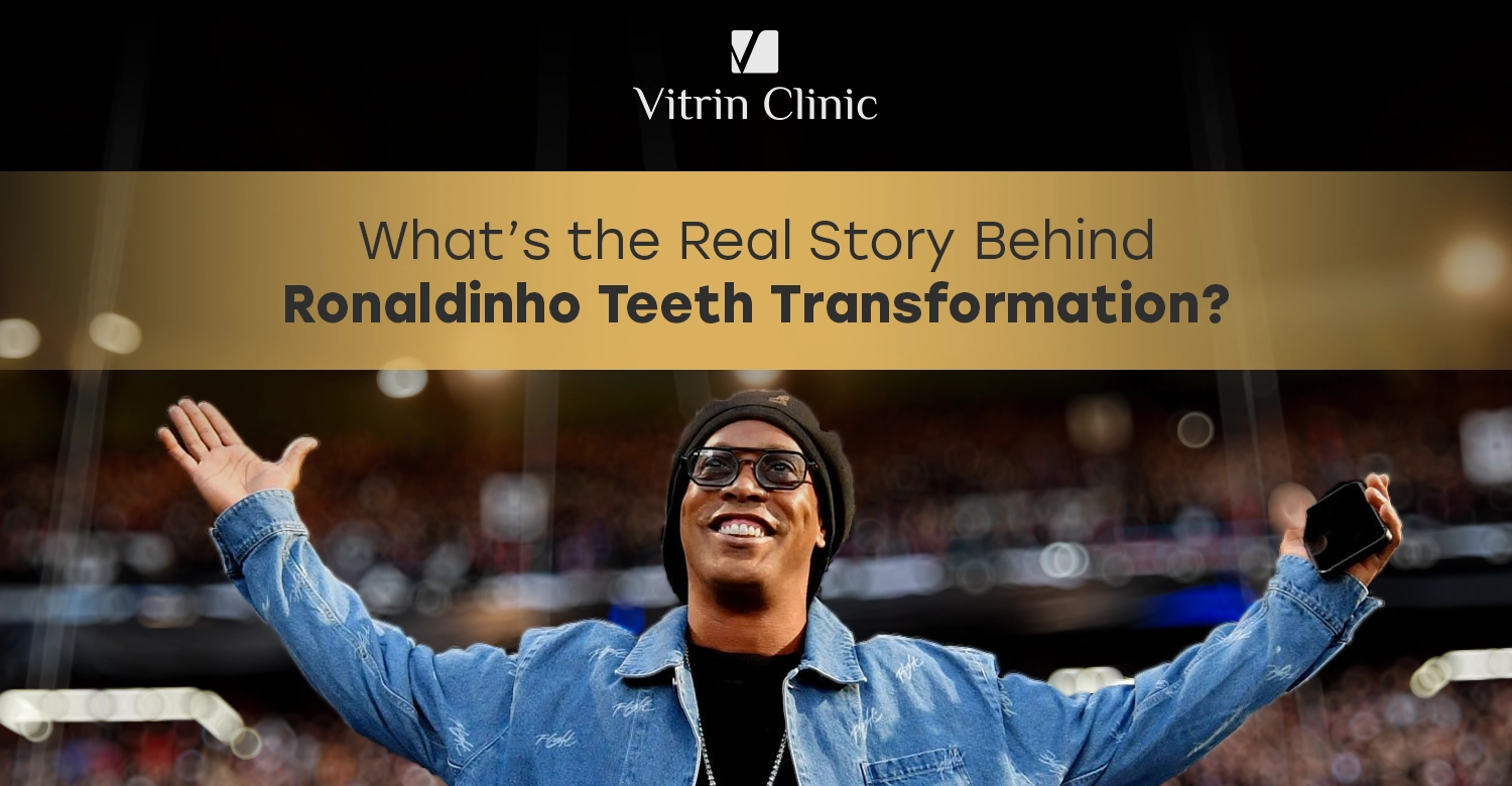 Ronaldinho Teeth