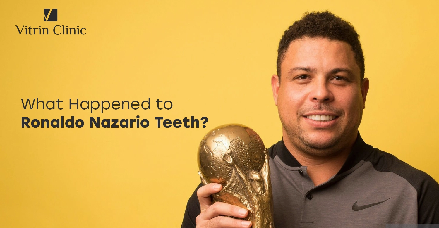 Ronaldo Nazario Teeth
