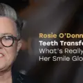 Rosie O’Donnell Teeth Transformation: What’s Really Behind Her Smile Glow-Up?