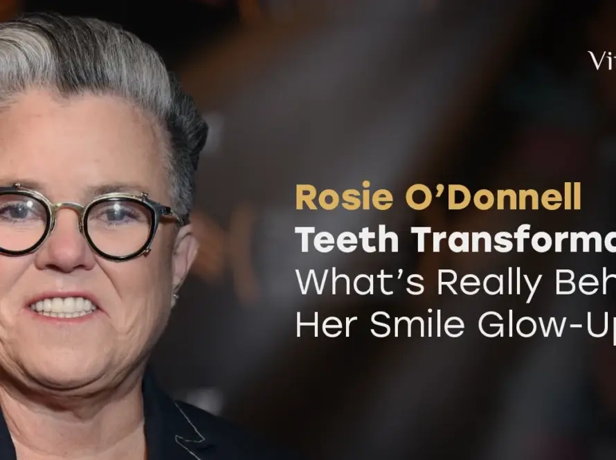 Rosie O’Donnell Teeth Transformation: What’s Really Behind Her Smile Glow-Up?