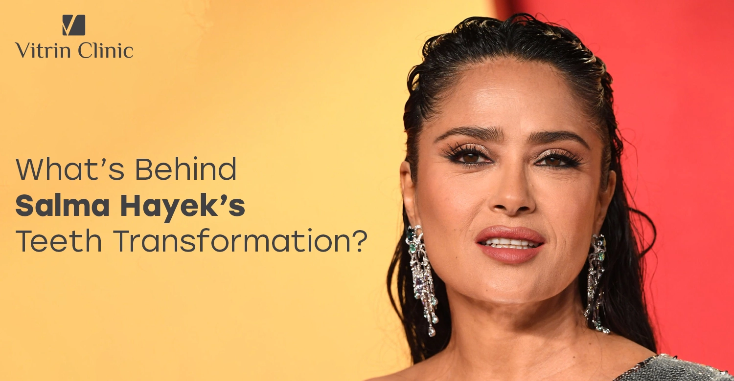 Salma Hayek Teeth