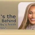 Unbelievable Transformation of Sasha Colby Teeth 2026!