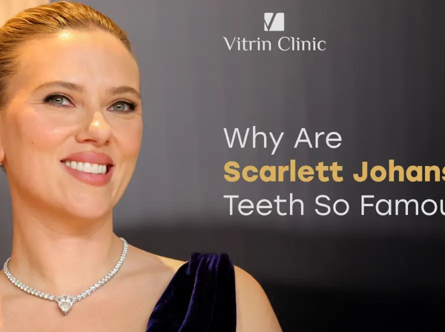 Scarlett Johansson Teeth