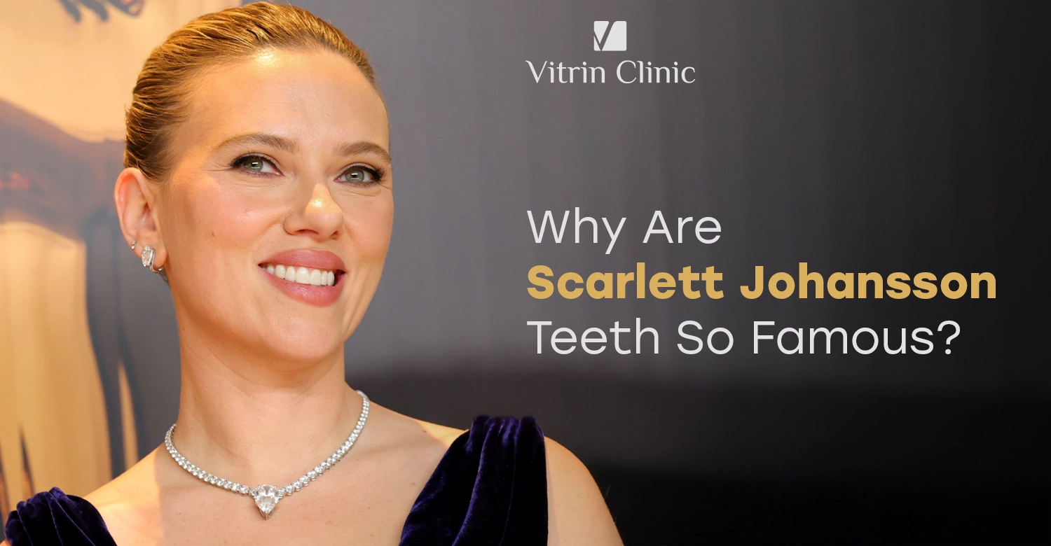 Scarlett Johansson Teeth