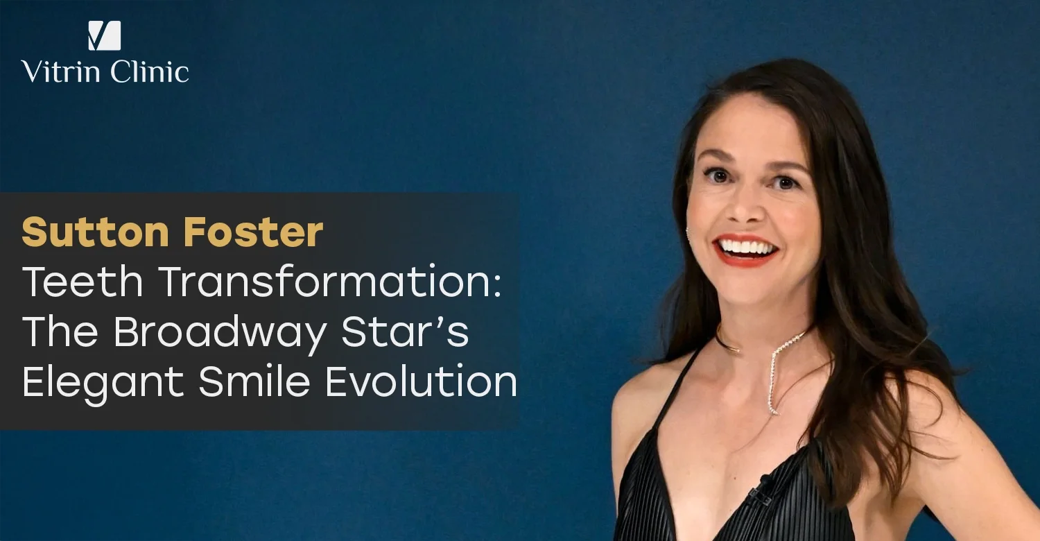 Sutton Foster Teeth Transformation: 5 Stunning Before &...