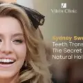  Who Is Sydney Sweeney and Why Are Her Teeth Getting Attention?