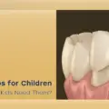 Best Teeth Caps for Children 2026: 5 Powerful Reasons They Matter?