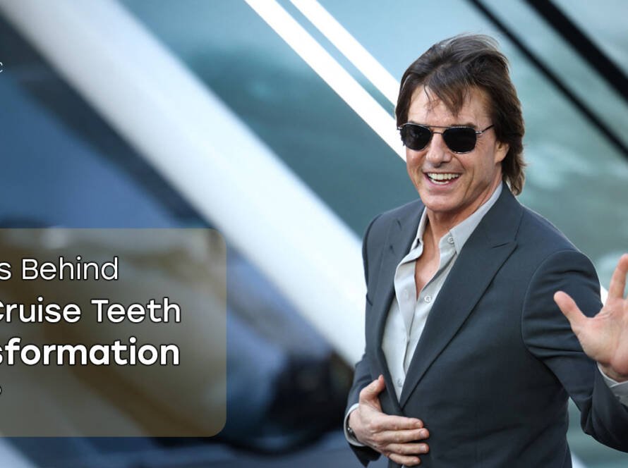 Dientes de Tom Cruise