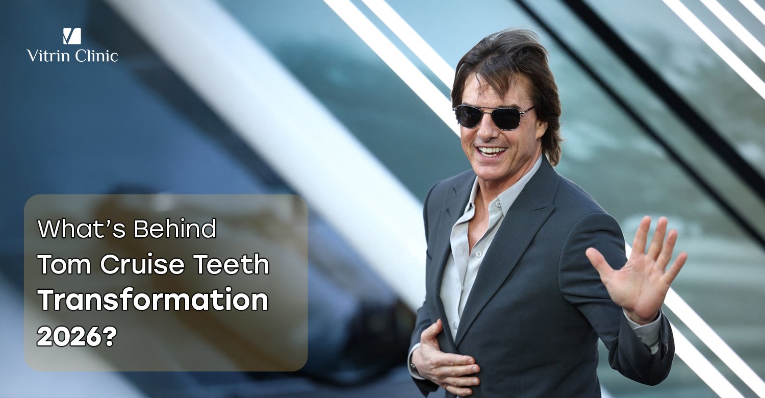 Tom Cruise Teeth