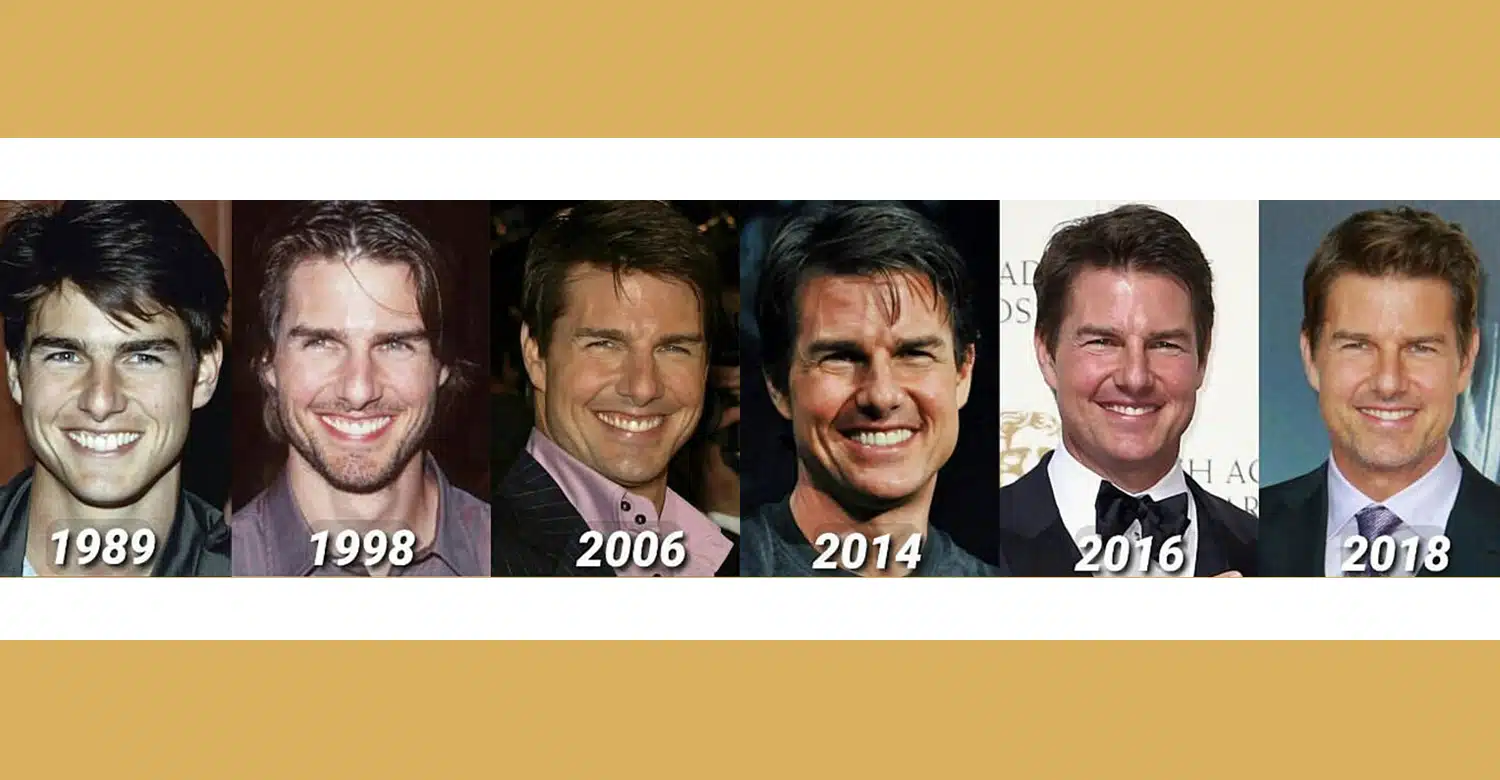 Tom Cruise middle tooth misalignment