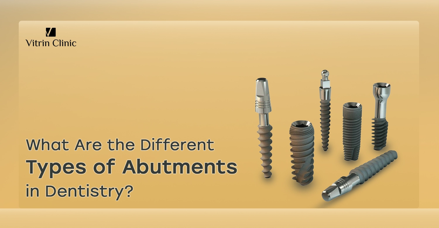 Types of abutments