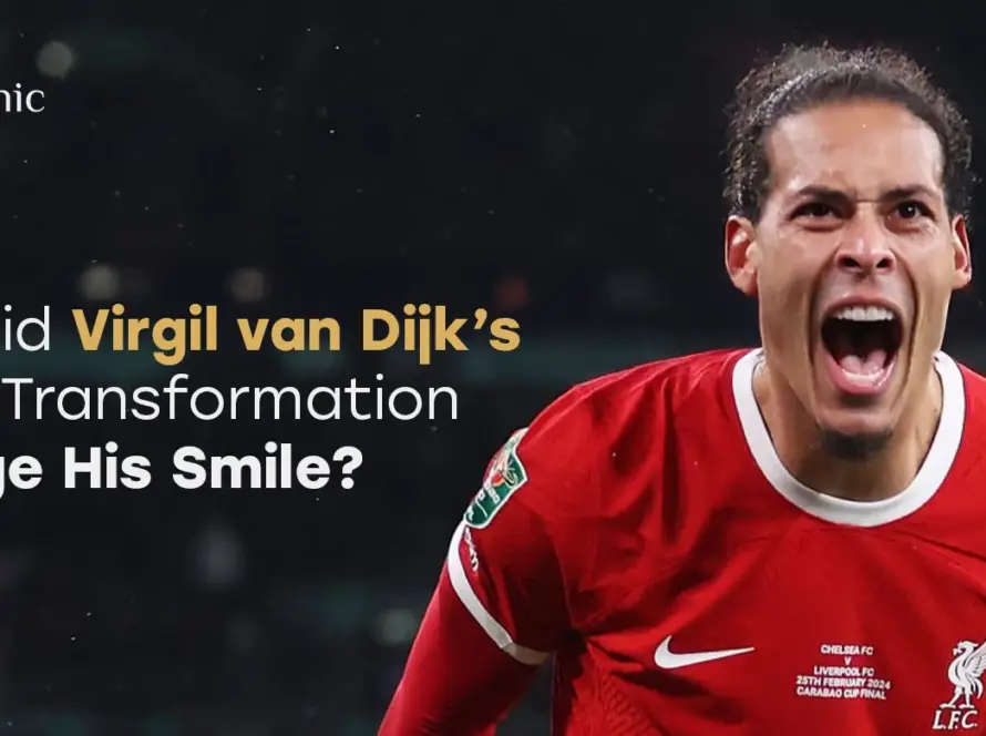 Virgil van Dijk Teeth Transformation