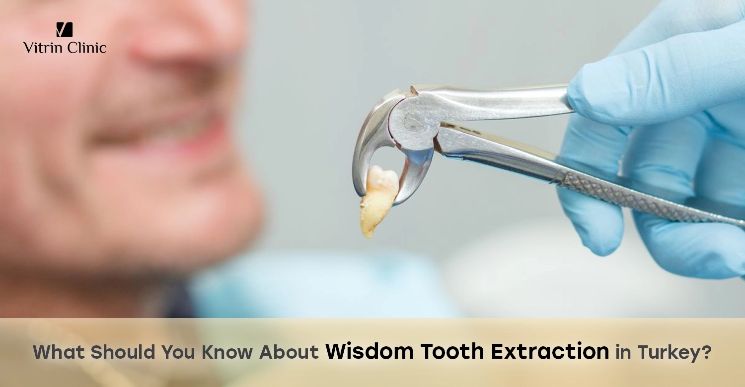Wisdom tooth extraction