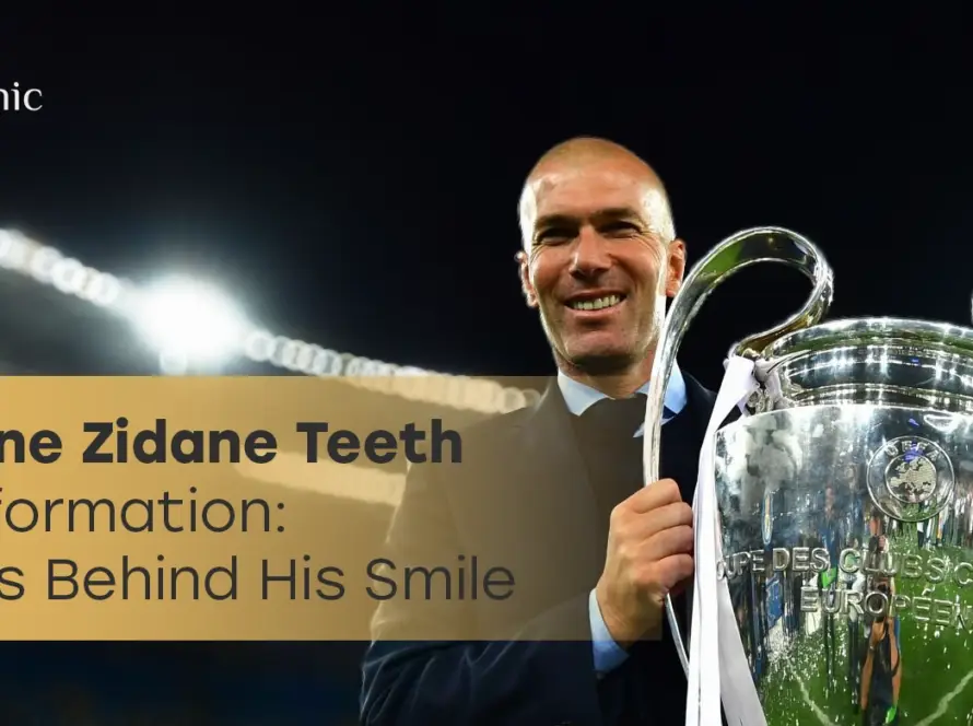 Zinedine Zidane Teeth Transformation: Before & after