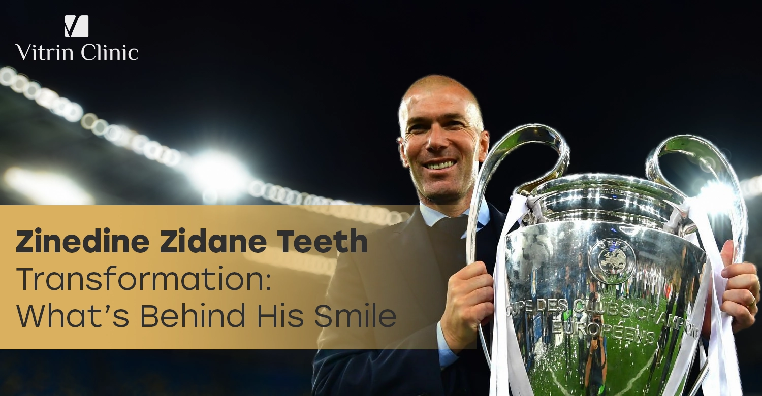 Zinedine Zidane Teeth Transformation: Before & after