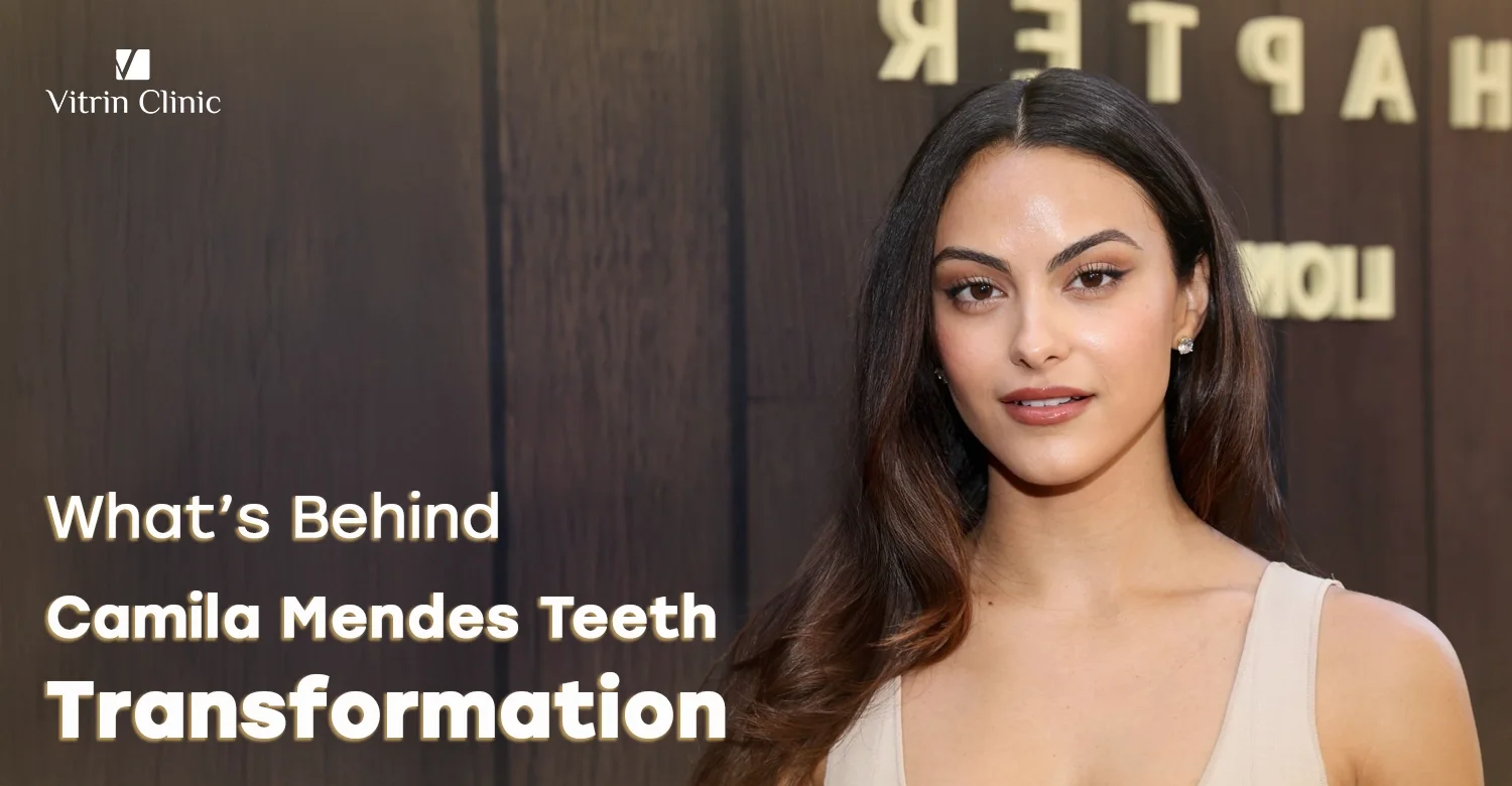 Camila Mendes teeth
