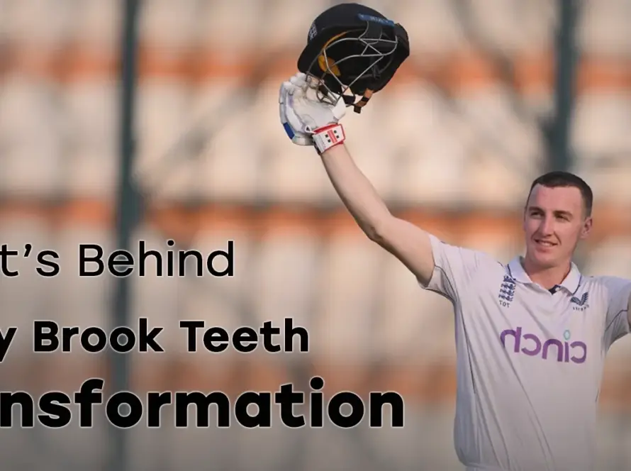 What’s Behind Harry Brook Teeth Transformation in 2026?