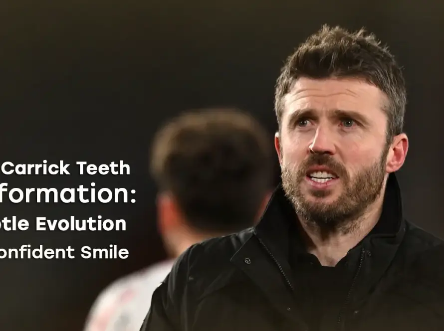 Michael Carrick Teeth