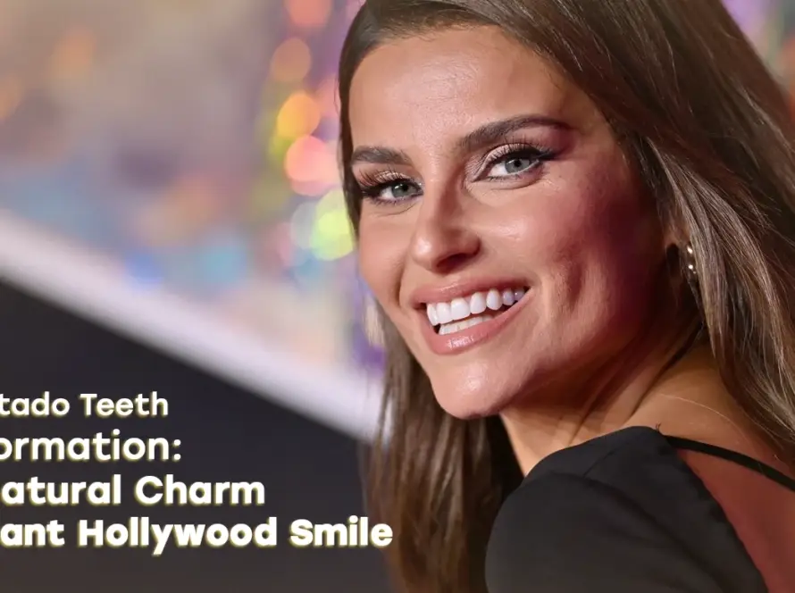 Explore Nelly Furtado Teeth transformation - Vitrin clinic