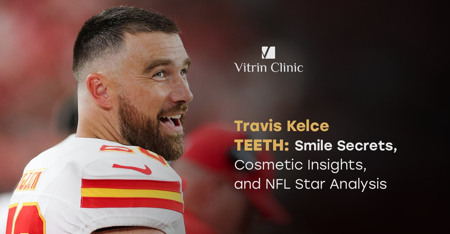 Travis Kelce Teeth