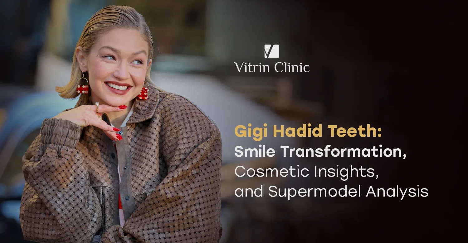 Gigi Hadid Teeth