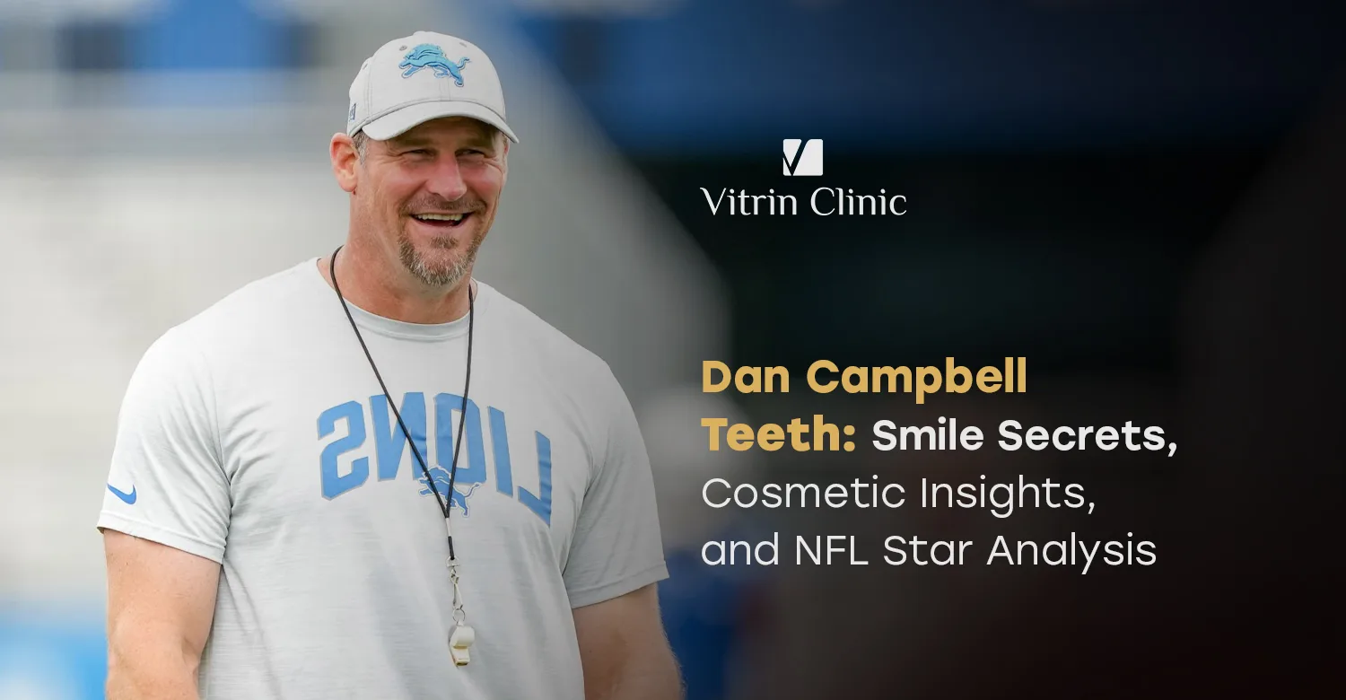 Dan Campbell Teeth