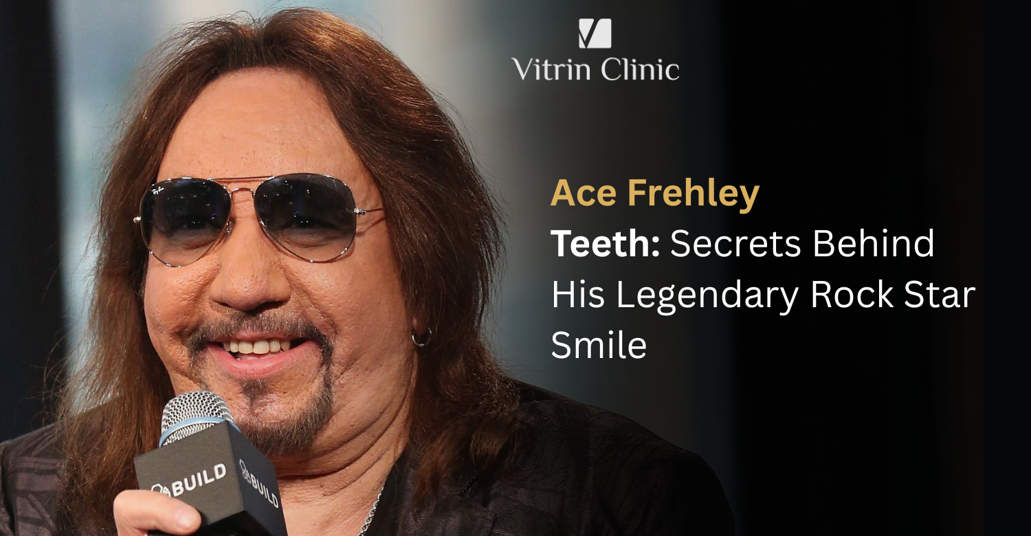 Ace Frehley Teeth