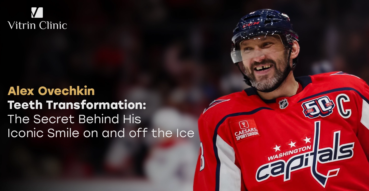 Alex Ovechkin Teeth Transformation: The Secret Behind His Iconic Smile on and off the Ice