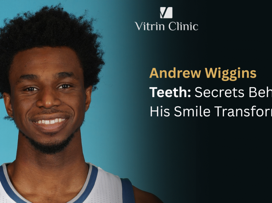Andrew Wiggins Teeth