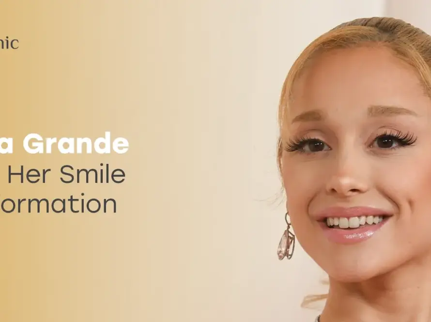 Ariana Grande Teeth: Before and After Her Iconic Smile Transformation