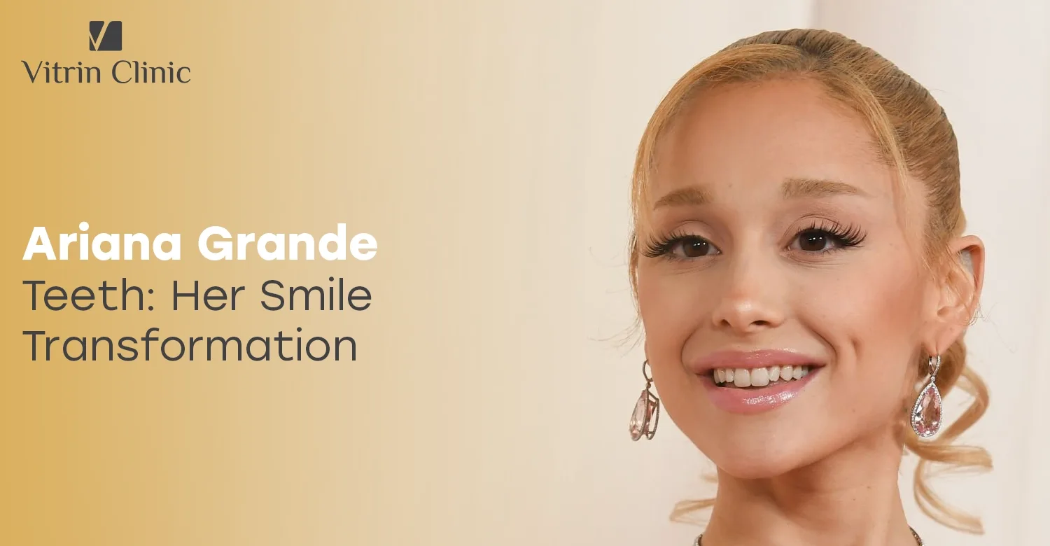 Ariana Grande Teeth: Before and After Her Iconic Smile Transformation