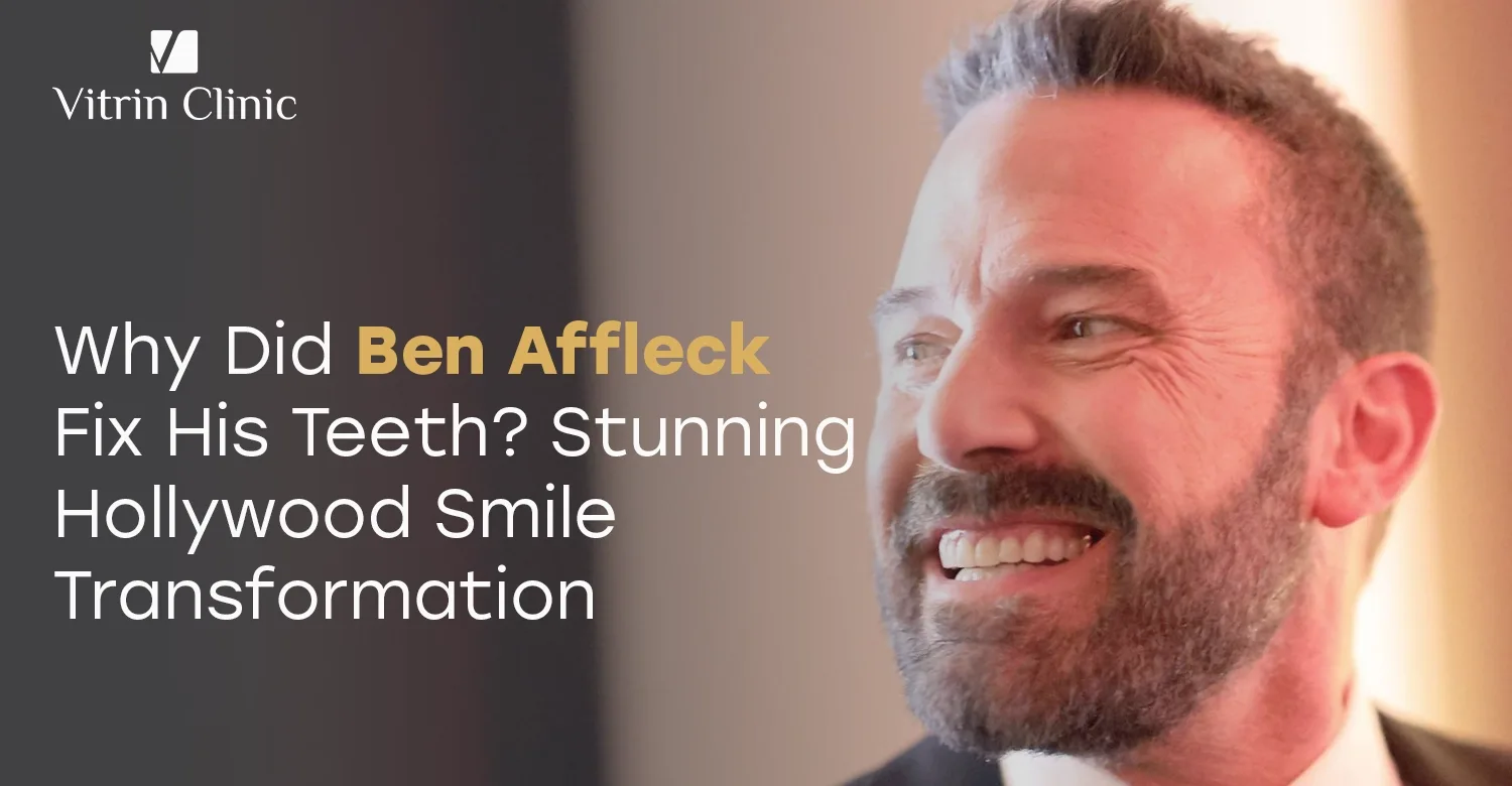 Ben Affleck Teeth: The Actor's Complete Smile Evolution