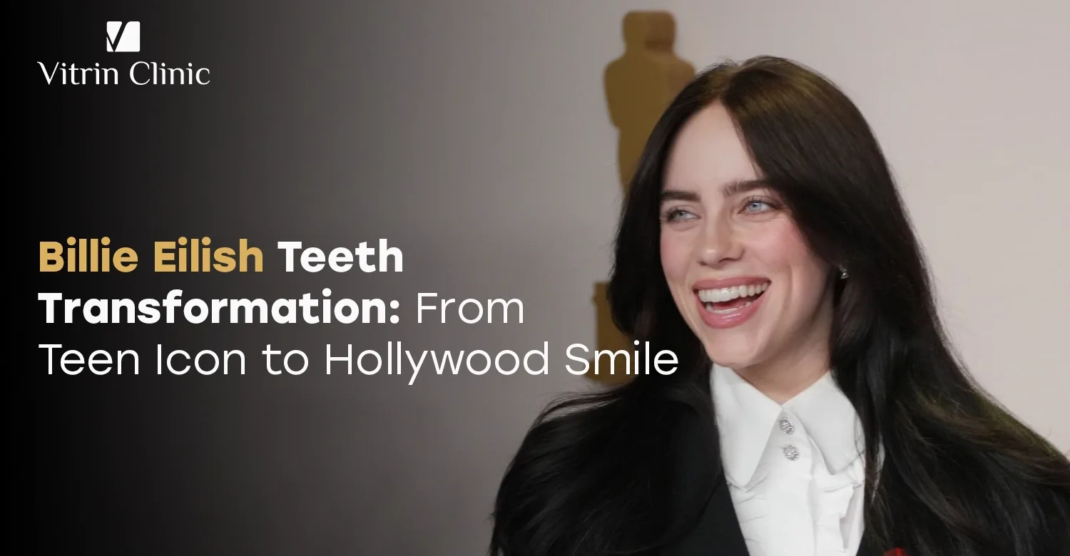 Billie Eilish Teeth Transformation: From Teen Icon to Hollywood Smile 2026