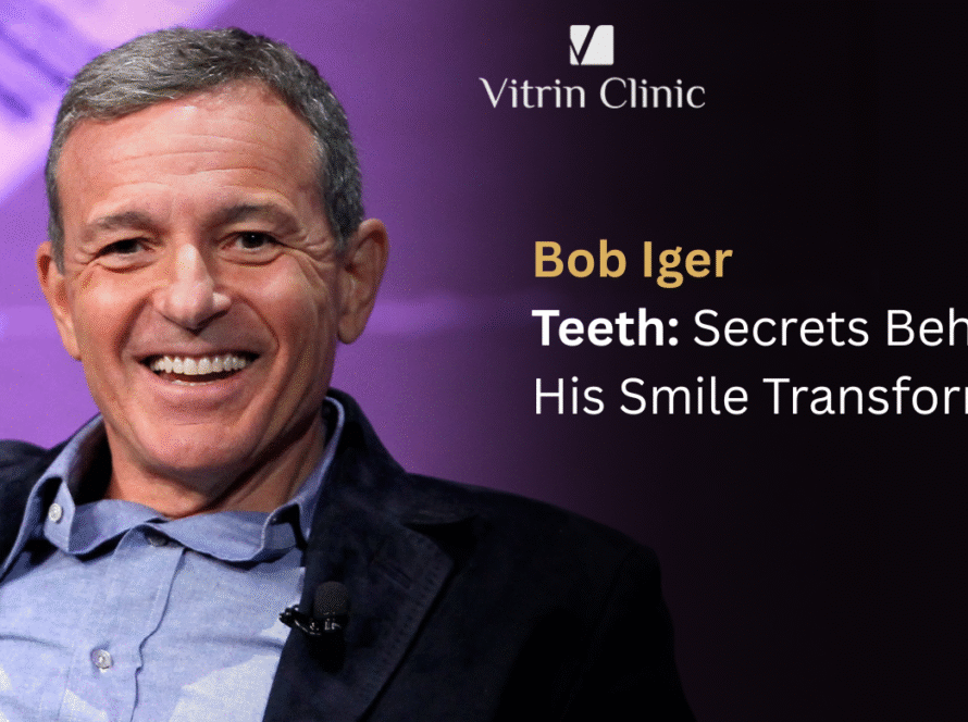Bob Iger Teeth: The Disney CEO's Complete Smile Evolution