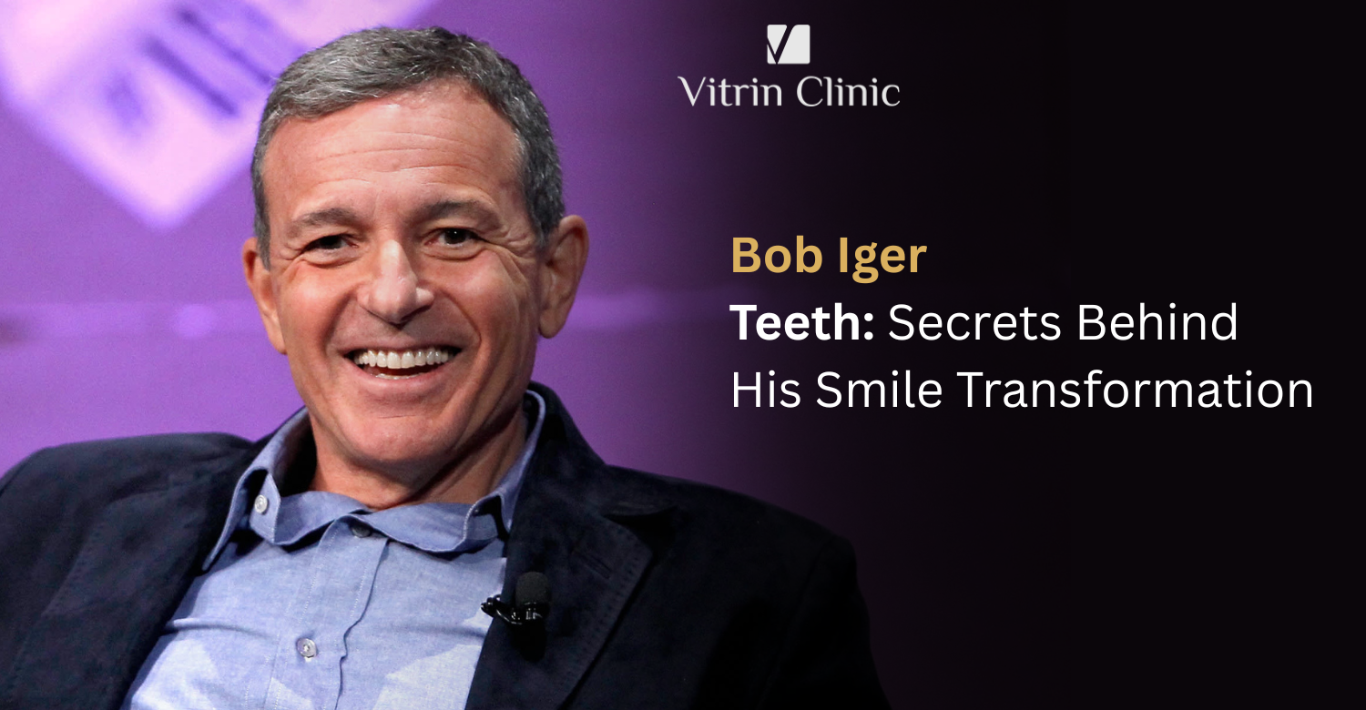 Bob Iger Teeth: The Disney CEO's Complete Smile Evolution