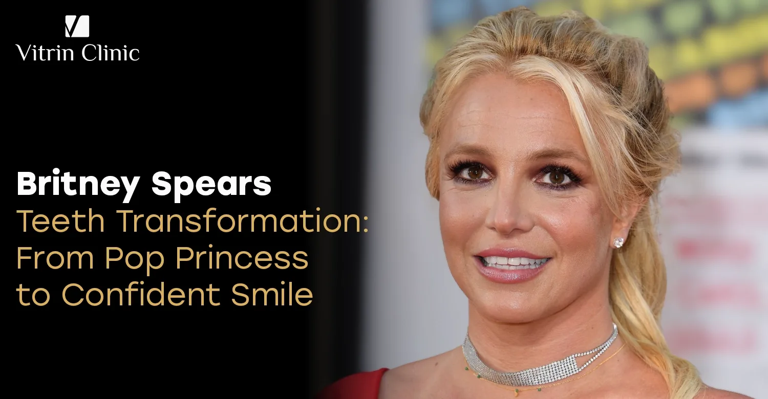 britney spears teeth