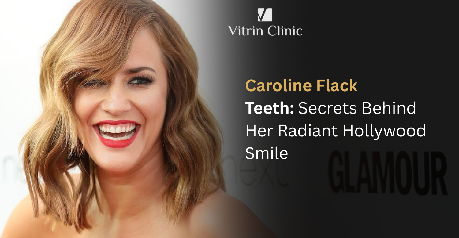 Caroline Flack Teeth: The TV Star's Complete Smile Evolution