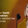 Celine Dion Teeth Transformation 2026: The Secret Behind Her Timeless Smile