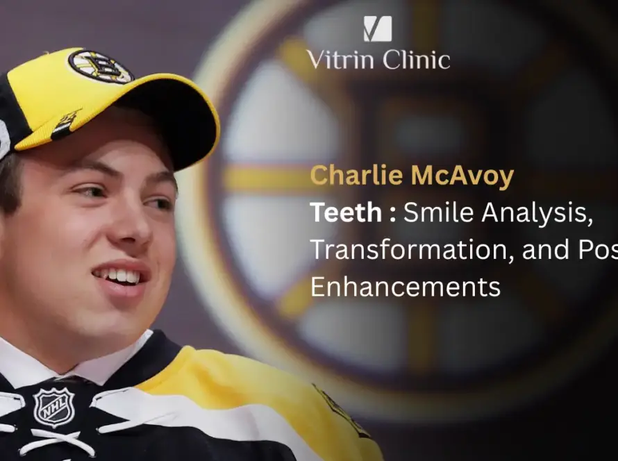 Charlie McAvoy Teeth